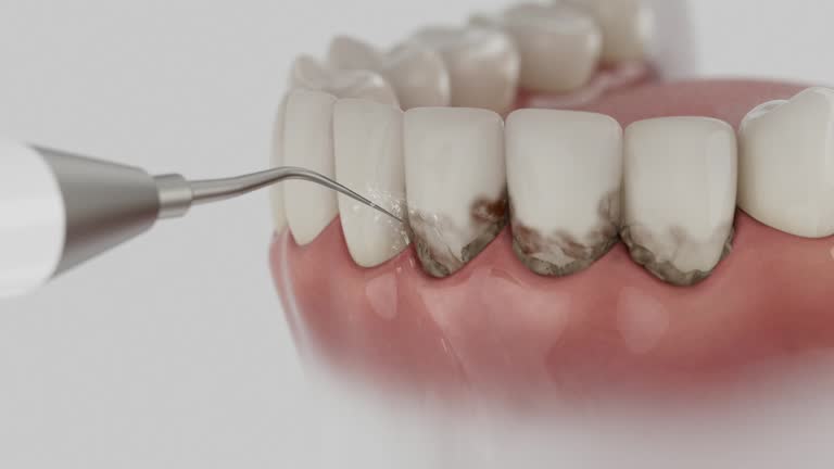 Reliable Dental contractor in Hidden Valley Lake, CA by Dentist Open Now